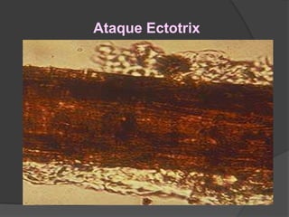 Ataque Ectotrix
 
