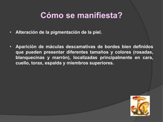 Cómo se manifiesta?
• Alteración de la pigmentación de la piel.
• Aparición de máculas descamativas de bordes bien definidos
que pueden presentar diferentes tamaños y colores (rosadas,
blanquecinas y marrón), localizadas principalmente en cara,
cuello, torax, espalda y miembros superiores.
 