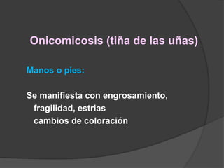 Onicomicosis (tiña de las uñas)
Manos o pies:
Se manifiesta con engrosamiento,
fragilidad, estrias
cambios de coloración
 