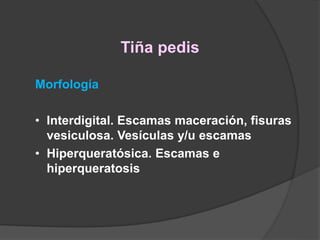Tiña pedis
Morfología
• Interdigital. Escamas maceración, fisuras
vesiculosa. Vesículas y/u escamas
• Hiperqueratósica. Escamas e
hiperqueratosis
 