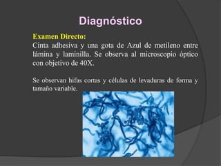 Diagnóstico
Examen Directo:
Cinta adhesiva y una gota de Azul de metileno entre
lámina y laminilla. Se observa al microscopio óptico
con objetivo de 40X.
Se observan hifas cortas y células de levaduras de forma y
tamaño variable.
 