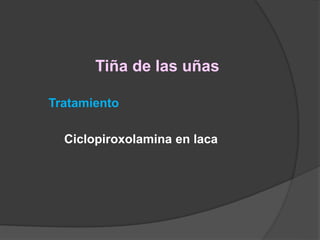 Tiña de las uñas
Tratamiento
Ciclopiroxolamina en laca
 