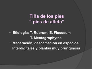 Tiña de los pies
“ pies de atleta”
• Etiología: T. Rubrum, E. Flocosum
T. Mentagrophytes
• Maceración, descamación en espacios
Interdigitales y plantas muy pruriginosa
 