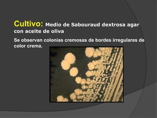 Cultivo: Medio de Sabouraud dextrosa agar
con aceite de oliva
Se observan colonias cremosas de bordes irregulares de
color crema.
 