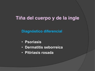 Tiña del cuerpo y de la ingle
Diagnóstico diferencial
• Psoriasis
• Dermatitis seborreíca
• Pitiriasis rosada
 