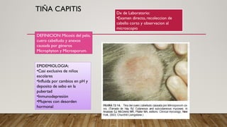 Sebo Capities micosis superficiales-2022456226447.pptx