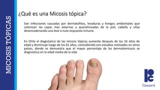 ¿Qué es una Micosis tópica?
Son infecciones causadas por dermatofitos, levaduras y hongos ambientales que
colonizan las capas más externas y queratinizadas de la piel, cabello y uñas
desencadenando una leve o nula respuesta inmune.
En Chile el diagnóstico de las micosis tópicas aumenta después de los 16 años de
edad y disminuye luego de los 61 años, coincidiendo con estudios realizados en otros
países, donde se demuestra que el mayor porcentaje de las dermatomicosis se
diagnostica en la edad media de la vida
 