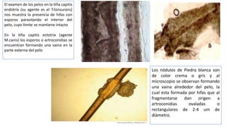 Endotrix micosis y parasitosis completo (2).pptx