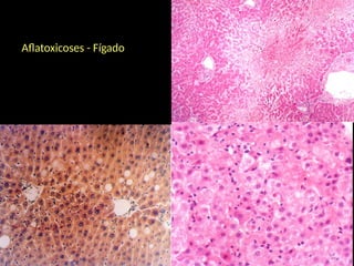 Aflatoxicoses - Fígado
 