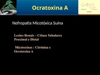 Ocratoxina A
Lesões Renais – Céluas Tubulares
Proximal e Distal
Micotoxinas : Citrinina e
Ocratoxina A
Nefropatia Micotóxica Suína
 