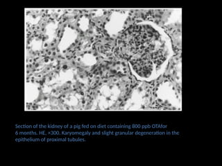 Section of the kidney of a pig fed on diet containing 800 ppb OTAfor
6 months. HE, ×300. Karyomegaly and slight granular degeneration in the
epithelium of proximal tubules.
 