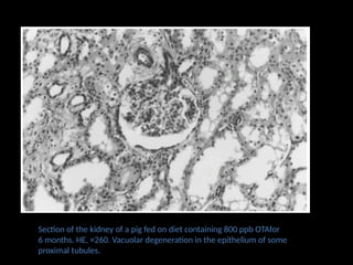 Section of the kidney of a pig fed on diet containing 800 ppb OTAfor
6 months. HE, ×260. Vacuolar degeneration in the epithelium of some
proximal tubules.
 