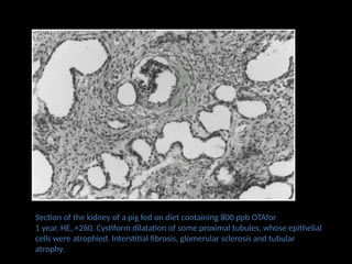 Section of the kidney of a pig fed on diet containing 800 ppb OTAfor
1 year. HE, ×260. Cystiform dilatation of some proximal tubules, whose epithelial
cells were atrophied. Interstitial fibrosis, glomerular sclerosis and tubular
atrophy.
 