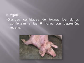 Aguda.
-Grandes cantidades de toxina, los signos
comienzan a las 6 horas con depresión;
muerte.


 