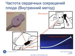 1. Опорожнение поддона для капель