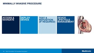 109
MINIMALLY INVASIVE PROCEDURE
ACCESS &
NAVIGATE
DEPLOY
DEVICE
TEST &
REPOSITION
(IF REQUIRED)
DEVICE
LIFECYCLE
MANAGEMENT
Micra™ AV and Micra™ VR Transcatheter Pacing Systems
 