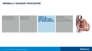 115
MINIMALLY INVASIVE PROCEDURE
ACCESS &
NAVIGATE
DEPLOY
DEVICE
TEST &
REPOSITION
(IF REQUIRED)
DEVICE
LIFECYCLE
MANAGEMENT
Micra™ AV and Micra™ VR Transcatheter Pacing Systems
 