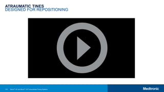 118
ATRAUMATIC TINES
DESIGNED FOR REPOSITIONING
Micra™ AV and Micra™ VR Transcatheter Pacing Systems
 