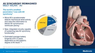 12
AV SYNCHRONY REIMAGINED
MEET MICRA™ AV
The world’s smallest
pacemaker,2 now with AV
synchrony1
 Micra AV’s accelerometer
detects mechanical atrial activity
and uses this information to
deliver AV synchronous
ventricular pacing.1
 New, integrated circuitry capable
of sustaining new AV synchrony
functionality.1
 Estimated average battery
longevity of 8-13 years,
dependent on the patient’s
degree of AV block.7,8
*AVB-only patients who would benefit from leadless pacing per the indications for
use.
Micra™ AV and Micra™ VR Transcatheter Pacing Systems
 
