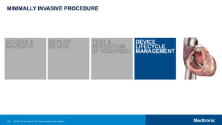 120
MINIMALLY INVASIVE PROCEDURE
ACCESS &
NAVIGATE
DEPLOY
DEVICE
TEST &
REPOSITION
(IF REQUIRED)
DEVICE
LIFECYCLE
MANAGEMENT
Micra™ AV and Micra™ VR Transcatheter Pacing Systems
 