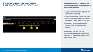 141
AV SYNCHRONY REIMAGINED
RATE SMOOTHING ALGORITHM1
Allows the device to preserve AV
synchrony through short periods of
atrial undersensing.
1. Appropriate atrial sensing with AV
synchronous pacing.
2. Atrial undersense. Ventricular pace
occurs at Rate Smoothing interval
instead of Lower Rate (1,200 ms).
3. Recovery of appropriate atrial
sensing with AV synchronous
pacing.
Nominally = 100 ms; can be
programmed longer for higher sinus
variability or shorter for patients with
stable sinus rates.
1 2 3
Micra™ AV and Micra™ VR Transcatheter Pacing Systems
 