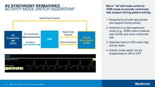 142
AV SYNCHRONY REIMAGINED
ACTIVITY MODE SWITCH ALGORITHM1
Micra™ AV will mode switch to
VDIR mode to provide ventricular
rate support during patient activity.
1. Designed to provide appropriate
rate support during activity.
2. Switches to a rate-responsive
mode (e.g., VDIR) when it detects
high activity and a low ventricular
rate.
3. Switches back to VDD when high
activity stops.
4. Activity mode switch can be
programmed to ON or OFF.
Needs Rate Support
AV Conduction
AV Block
Activity
Mode Switch
(VDIR)
VDD
Needs Rate
Support
Activity Stopped
AV
Conduction
MS
(VVI+)
Micra™ AV and Micra™ VR Transcatheter Pacing Systems
 