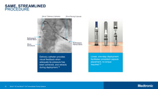 23
SAME, STREAMLINED
PROCEDURE
Delivery catheter provides
visual feedback when
adequate tip pressure has
been achieved, and retracts
during deployment.16
Linear, one-step deployment
facilitates consistent capsule
placement; no torque
required.20
Micra™ AV and Micra™ VR Transcatheter Pacing Systems
 