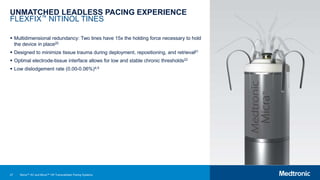 27
UNMATCHED LEADLESS PACING EXPERIENCE
FLEXFIX™ NITINOL TINES
 Multidimensional redundancy: Two tines have 15x the holding force necessary to hold
the device in place20
 Designed to minimize tissue trauma during deployment, repositioning, and retrieval21
 Optimal electrode-tissue interface allows for low and stable chronic thresholds22
 Low dislodgement rate (0.00-0.06%)4,5
Micra™ AV and Micra™ VR Transcatheter Pacing Systems
 