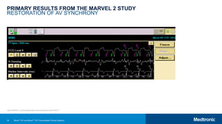 35
PRIMARY RESULTS FROM THE MARVEL 2 STUDY
RESTORATION OF AV SYNCHRONY
Note: MARVEL 2 clinical data slides were presented at AHA 2019.25
Micra™ AV and Micra™ VR Transcatheter Pacing Systems
 