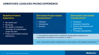 5
UNMATCHED LEADLESS PACING EXPERIENCE
Redefined Patient
Experience
 No chest scar
 No bump
 No visible or physical
reminder of a pacemaker
under the skin
 Fewer post-implant activity
restrictions
Eliminated Pocket-related
Complications11
 Infection
 Hematoma
 Erosion
Eliminated Lead-related
Complications11
 Fractures
 Insulation breaches
 Venous thrombosis and
obstruction
 Tricuspid regurgitation
Lead- and pocket-related complications can be costly to the hospital and patient.10
~1 in 8 patients treated with a traditional pacing system experience a
complication attributed to the pocket or leads.11
Micra™ AV and Micra™ VR Transcatheter Pacing Systems
 