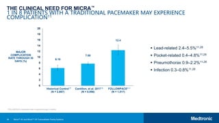 54
THE CLINICAL NEED FOR MICRA™
1 IN 8 PATIENTS WITH A TRADITIONAL PACEMAKER MAY EXPERIENCE
COMPLICATION11
6.15
7.68
12.4
0
2
4
6
8
10
12
14
16
18
20
Historical Control
(N = 2,667)
Cantillon, et al. 2017
(N = 8,956)
FOLLOWPACE*
(N = 1,517)
MAJOR
COMPLICATION
RATE THROUGH 30
DAYS (%)
*FOLLOWPACE complication rate is reported through 2 months.
 Lead-related 2.4–5.5%11,28
 Pocket-related 0.4–4.8%11,28
 Pneumothorax 0.9–2.2%11,28
 Infection 0.3–0.8%11,28
17 10 11
Micra™ AV and Micra™ VR Transcatheter Pacing Systems
 