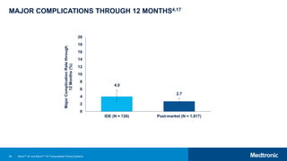 56
MAJOR COMPLICATIONS THROUGH 12 MONTHS4,17
4.0
2.7
0
2
4
6
8
10
12
14
16
18
20
IDE (N = 726) Post-market (N = 1,817)
Major
Complication
Rate
through
12
Months
(%)
Micra™ AV and Micra™ VR Transcatheter Pacing Systems
 