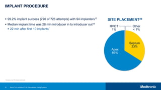 61
IMPLANT PROCEDURE
 99.2% implant success (720 of 726 attempts) with 94 implanters17
 Median implant time was 28 min introducer in to introducer out18
 22 min after first 10 implants*
SITE PLACEMENT29
Apex
66%
Septum
33%
RVOT
1%
Other
< 1%
*Includes only 725 implant attempts.
Micra™ AV and Micra™ VR Transcatheter Pacing Systems
 