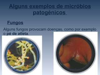 Alguns exemplos de micróbios patogénicos  Fungos Alguns fungos provocam doenças, como por exemplo o  pé de atleta . 