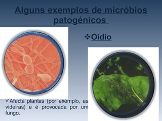 Alguns exemplos de micróbios patogénicos  Afecta plantas (por exemplo, as videiras) e é provocada por um fungo.  Oídio 