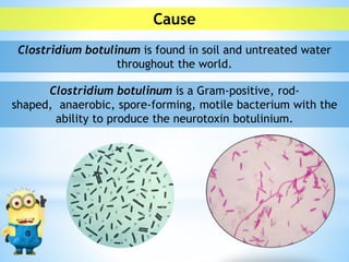Diseases Caused by Microorganisms- Botulism | PPTX