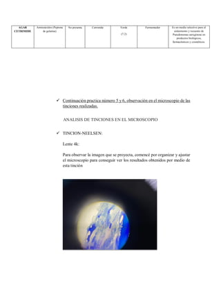  Continuación practica número 5 y 6, observación en el microscopio de las
tinciones realizadas.
ANALISIS DE TINCIONES EN EL MICROSCOPIO
 TINCION-NEELSEN:
Lente 4k:
Para observar la imagen que se proyecta, comencé por organizar y ajustar
el microscopio para conseguir ver los resultados obtenidos por medio de
esta tinción
AGAR
CETRIMIDE
Aminoácidos (Peptona
de gelatina)
No presenta Cetrimide Verde
(7.2)
Fermentador Es un medio selectivo para el
aislamiento y recuento de
Pseudomonas aeruginosa en
productos biológicos,
farmacéuticos y cosméticos.
 