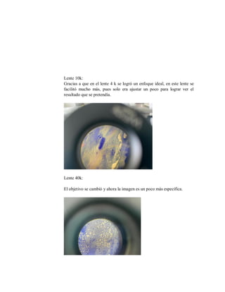 Lente 10k:
Gracias a que en el lente 4 k se logró un enfoque ideal, en este lente se
facilitó mucho más, pues solo era ajustar un poco para lograr ver el
resultado que se pretendía.
Lente 40k:
El objetivo se cambió y ahora la imagen es un poco más específica.
 