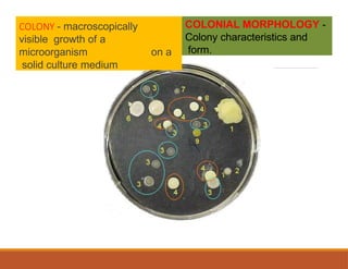 Colony morphology of bacteria, their IDs | PPTX