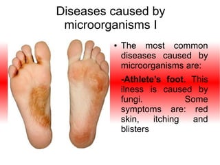 Diseases caused by
microorganisms I
●

The most common
diseases caused by
microorganisms are:
-Athlete’s foot. This
ilness is caused by
fungi.
Some
symptoms are: red
skin,
itching
and
blisters

 