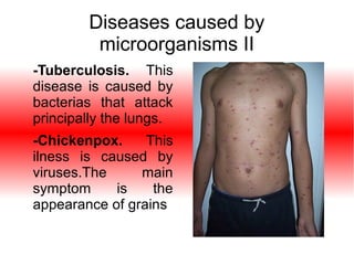 Diseases caused by
microorganisms II
-Tuberculosis. This
disease is caused by
bacterias that attack
principally the lungs.
-Chickenpox.
This
ilness is caused by
viruses.The
main
symptom
is
the
appearance of grains

 