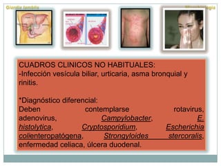 CUADROS CLINICOS NO HABITUALES:
-Infección vesícula biliar, urticaria, asma bronquial y
rinitis.
*Diagnóstico diferencial:
Deben contemplarse rotavirus,
adenovirus, Campylobacter, E.
histolytica, Cryptosporidium, Escherichia
colienteropatógena, Strongyloides stercoralis,
enfermedad celiaca, úlcera duodenal.
 