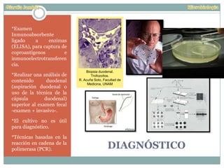 DIAGNÓSTICO
*Examen
Inmunoabsorbente
ligado a enzimas
(ELISA), para captura de
coproantígenos e
inmunoelectrotransferen
cia.
*Realizar una análisis de
contenido duodenal
(aspiración duodenal o
uso de la técnica de la
cápsula duodenal)
superior al examen fecal
-examen + invasivo-.
*El cultivo no es útil
para diagnóstico.
*Técnicas basadas en la
reacción en cadena de la
polimerasa (PCR).
Biopsia duodenal.
Trofozoítos.
R. Acuña Soto, Facultad de
Medicina, UNAM
 
