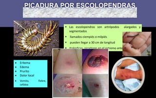 enfermedades-causadas-por-artropodos-pptx