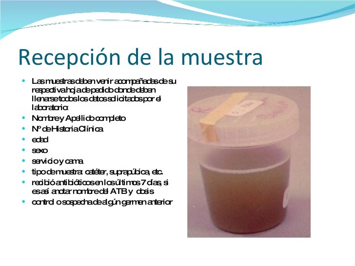 El vídeo la hipnosis el modo fácil a dejar fumar