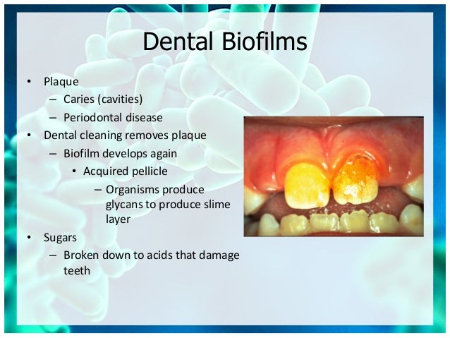 Micro chapter 31 biofilms - architects of disease