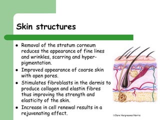 Micro dermabrasion | PPTX