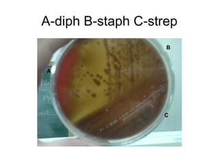 Staphylococcus & streptococcus | PPT