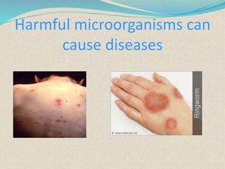 Harmful microorganisms can
cause diseases
 