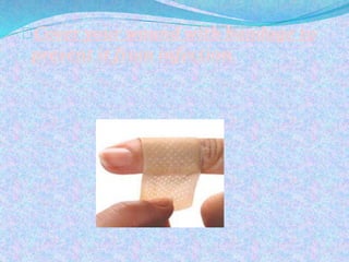 Cover your wound with bandage to
prevent it from infection
 
